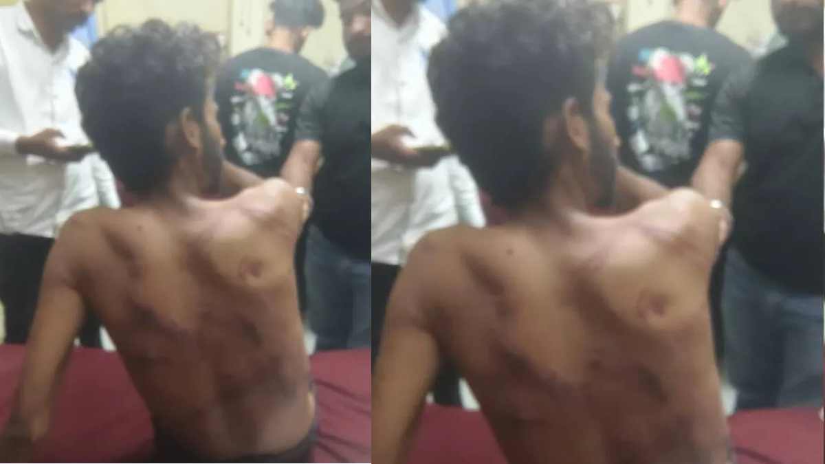 Instagram पर लड़की बनकर युवक को बुलाया, फिर पाइप-बेल्ट से पीटा; 5 आरोपी हिरासत में